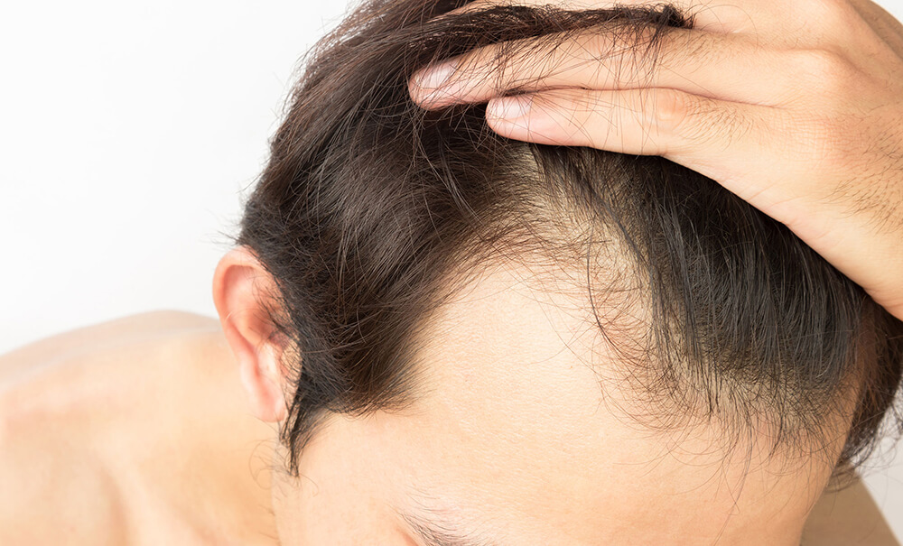 علاجات الشعر الغير جراحية